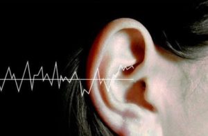 tinnitus