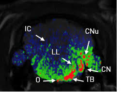 tinnitus-research-info-2019-02