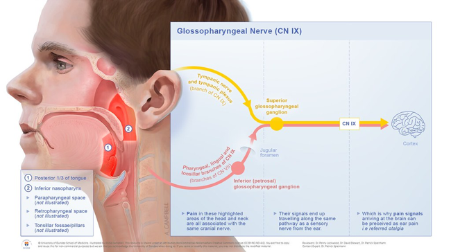 Retraining Therapy for Tinnitus